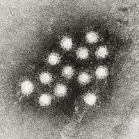 Amit a fertőző májgyulladás-járványról tudni kell